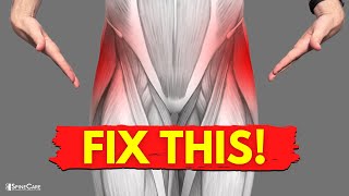 How to Relieve Tight Hips in SECONDS