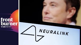 What’s going on at Neuralink, Musk’s brain implant company?
