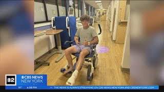Teen shares experience after being bitten by shark off Long Island