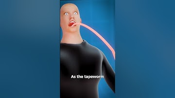 What Is A Tapeworm? 😨