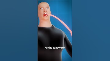 Thumbnail of What Is A Tapeworm? 😨