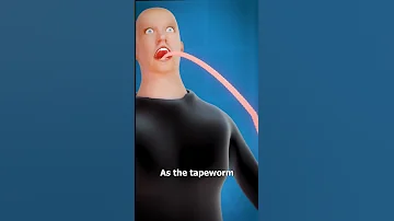 What Is A Tapeworm 