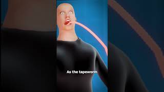 what is a tapeworm? 😨