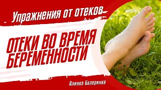 Отеки во время беременности. Упражнения от отеков. Что делать с отеками.