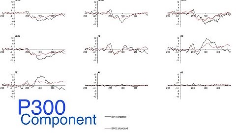 P300 Component EEGLab
