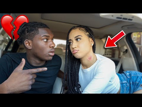 HICKEY PRANK ON MY BOYFRIEND *BIG MISTAKE!*