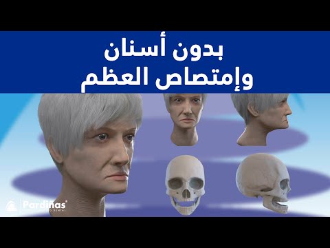 فيديو: ما هو ارتشاف الأسنان في القطط؟