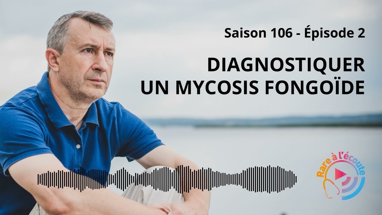 Maladie rare – Diagnostiquer un mycosis fongoïde