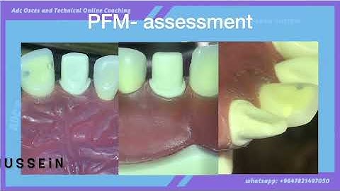 pfm assessment