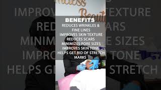 Microneedling – Dallas Texas – Timeless Beauty Med Spa #skincare #facial #beauty #skincareroutine