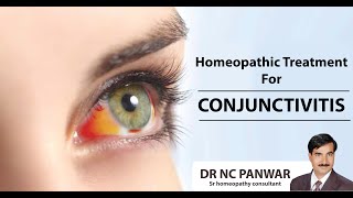 Cosectivivites treatment homeopathy treatment