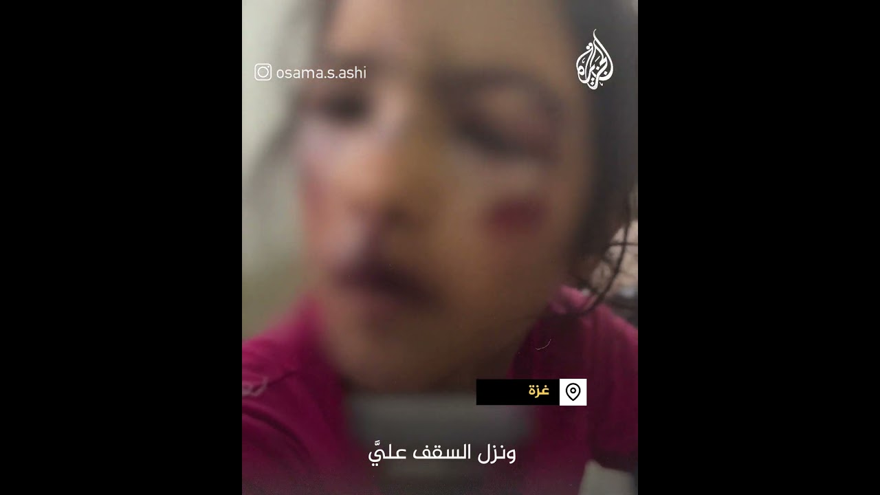 طفلة تروي كيف استهدفها الاحتلال وهي نائمة في مدرسة نازحين غرب غزة