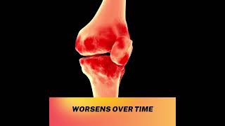 Consequences of Untreated Osteoarthritis