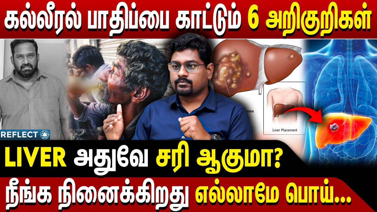 இத கவனிக்கலைனா கண்டிப்பா Cancer | Dr. Gobinath BHMS | Liver Diseases And Symptoms