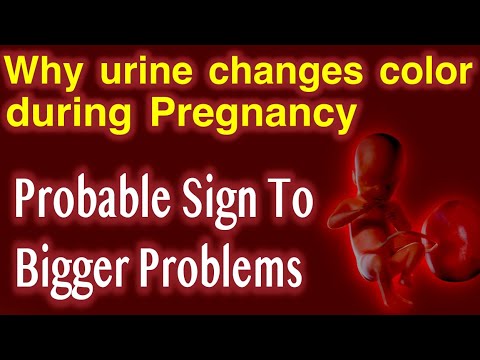 Video: Kan donkere urine een teken zijn van zwangerschap?