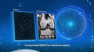 Ultimate precision at maximum speed with Philips SmartSpeed Precise