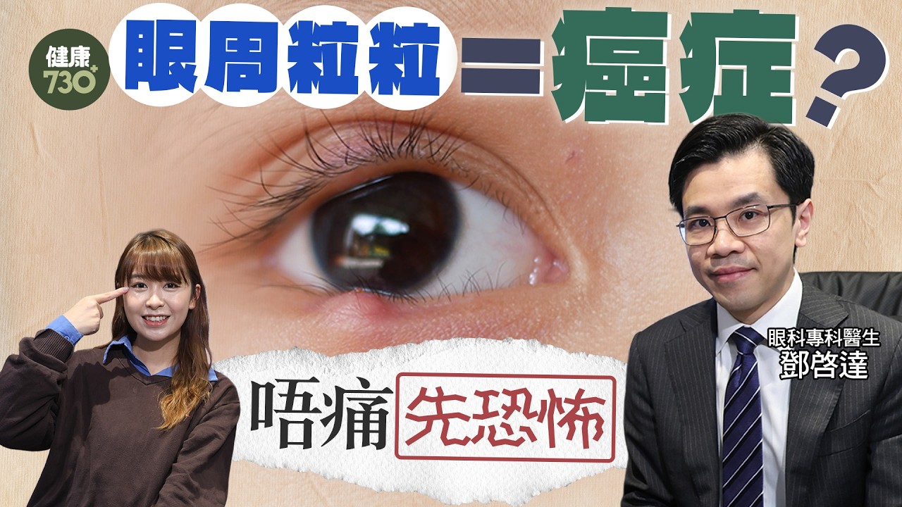 眼周生粒粒唔痛就放心？眼科醫生教你分辨良性惡性 嚴重可致失明甚至致命 卸妝後多做一步防生瘡