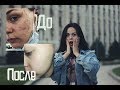 КАК Я ИЗБАВИЛАСЬ ОТ ПРЫЩЕЙ | Моя история лечения