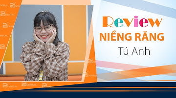 [Review niềng răng]: #275 Kết quả niềng răng của Tú Anh