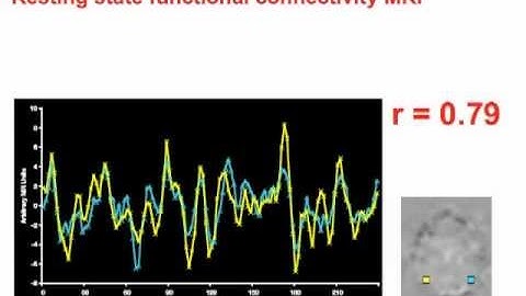 Network Organization of the Human Brain