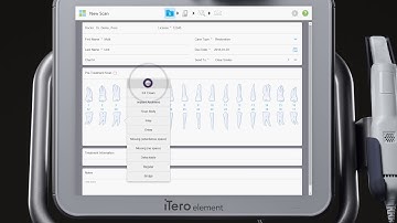 iTero® Scanner Tutorial: Charting for Multi Unit Cases