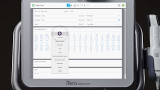 iTero® Scanner Tutorial: Charting for Multi Unit Cases screenshot 3