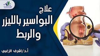 علاج البواسير بالليزر والربط - أ.د/ اشرف الزغبي