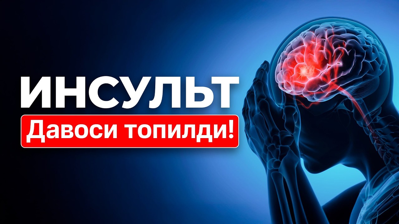 Инсульт қандай содир бўлади? Невропатолог сабабини тушунтиради