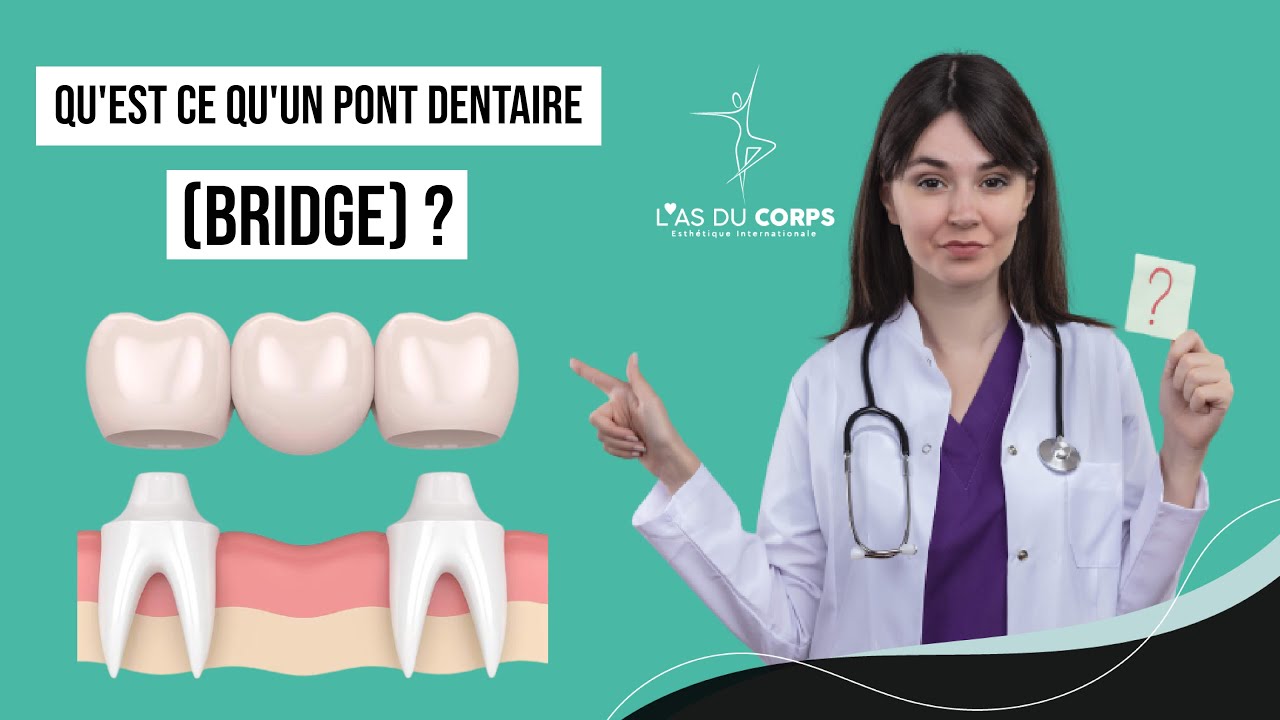 QU'EST CE QU'UN PONT DENTAIRE ( bridge ) ? | L'as du corps