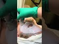 Repair &amp; Glow Facial | Deep Cleansing + Dr. Grandel Ampoule + RF + LED Red Light | Skincare by Rano