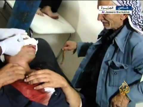 معاناة أهالي الزبداني من تواصل القصف
