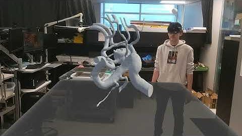 Holographic Visualization of Neurovascular Aneurysm AR Demo