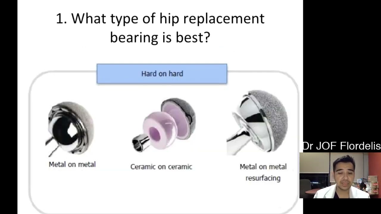 @everyone The choice of hip replacement bearing, or the material that forms the surfaces of the hip