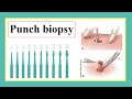 punch biopsy