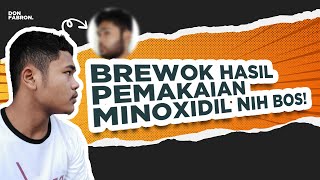 Penampilan Berubah Drastis Setelah Numbuhin Brewok Jadi Berwibawa