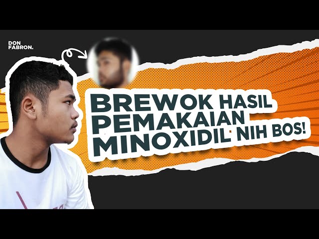 Penampilan Berubah Drastis Setelah Numbuhin Brewok Jadi Berwibawa class=