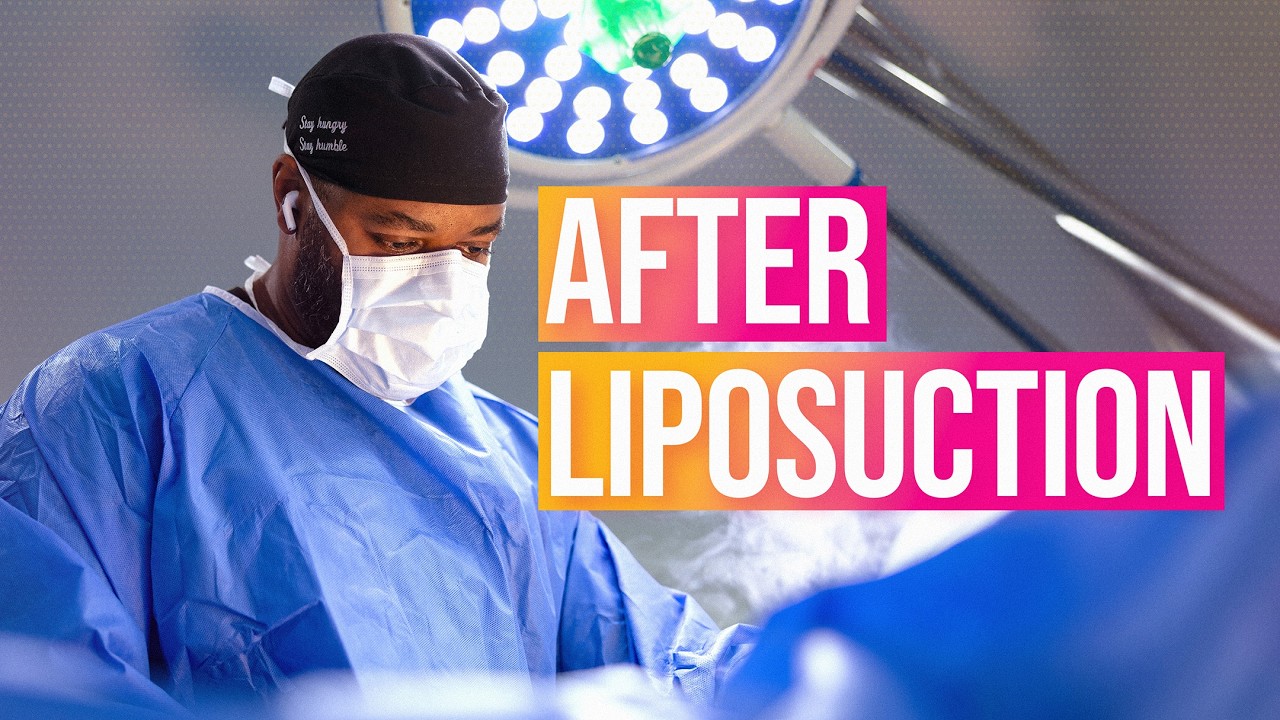 Мастер-класс по липосакции (II): результаты, восстановление и распространенные мифы.