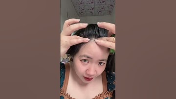 Bạn có đang stress vì tóc gãy rụng nhiều?