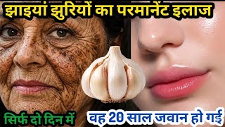 इतनी तेजी से झाइयां खत्म हुई ,सभी हैरान रह गए 😱 मेरी चाची गोरी भी हुई 🥰
