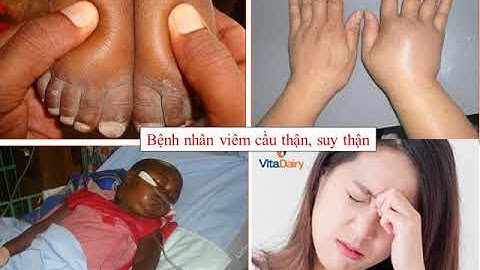 Sinh học 8 Bài 39  Bài tiết nước tiểu