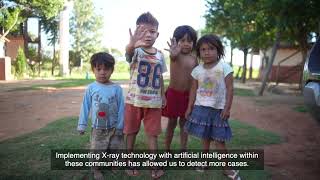 Active Tuberculosis Case Finding in Paraguay  - (World Tuberculosis Day 2024: Paraguay)