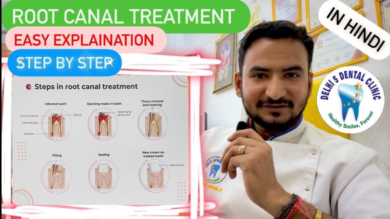 Root Canal Treatment Root canal infection treatment Doctor explains