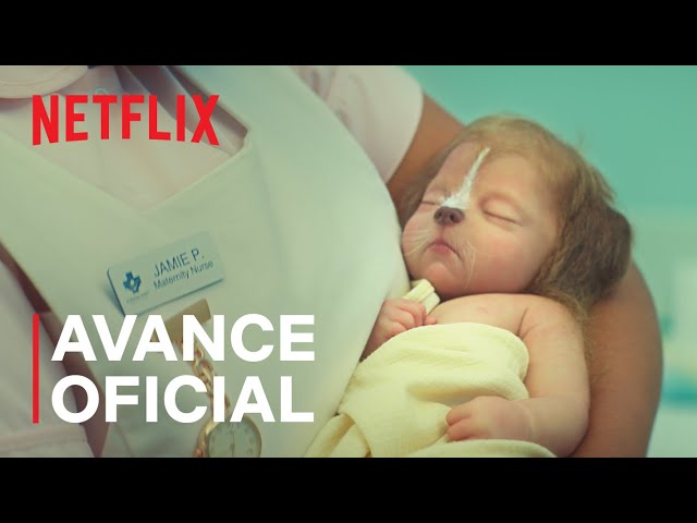 Netflix 21 Datos Curiosos Detras De La Serie Sweet Tooth El Destape Netflix 21 Datos Curiosos Detras De La Serie Sweet Tooth El Destape