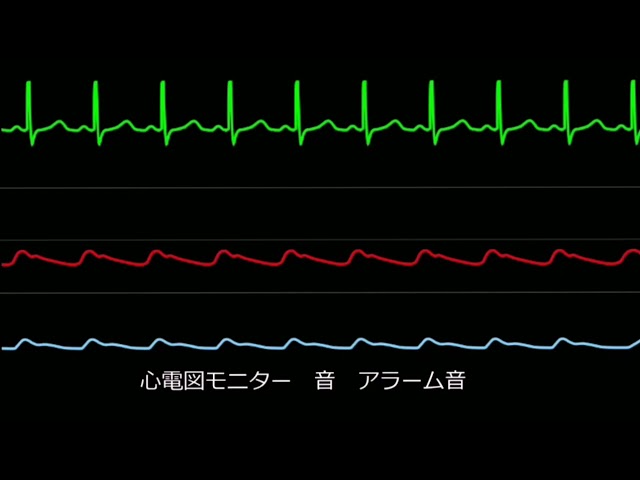 病院・心電図 ピッ ピッ ピーーーーーー（効果音）Electrocardiogram Sound Effect