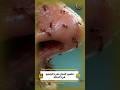 تفسير النمل على الجسم في المنام تفسير الأحلام 