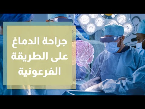 جراحة الدماغ على الطريقة الفرعونية أنجح من الأدوية