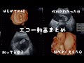 【4Dエコー】妊娠中エコー動画全まとめ【ママの解説＆感想付き】