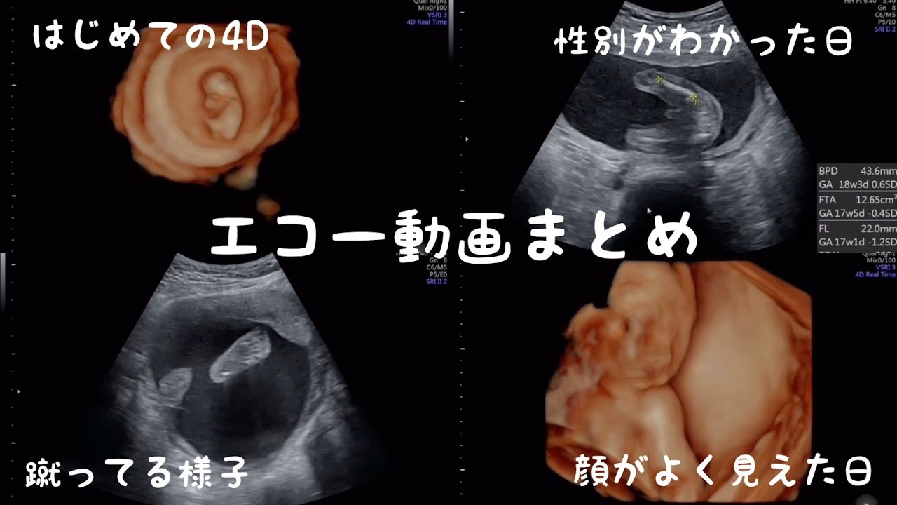 4dエコー 男の子妊娠中エコー動画全まとめ ママの解説 感想付き Youtube