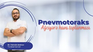 Pnevmotoraks - Ağciyərdə hava toplanması. Pnevmotoraksa kimlərdə rast gəlinir və səbəbi nədir?