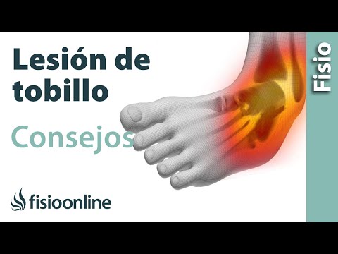 Video: Cómo evitar lesiones (masajistas): 15 pasos (con imágenes)